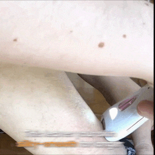 Step 1